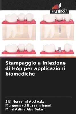 Stampaggio a iniezione di HAp per applicazioni biomediche 1