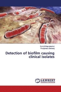 bokomslag Detection of biofilm causing clinical isolates