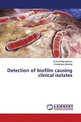 Detection of biofilm causing clinical isolates 1