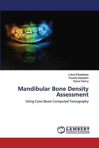 bokomslag Mandibular Bone Density Assessment