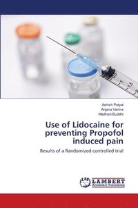 bokomslag Use of Lidocaine for preventing Propofol induced pain