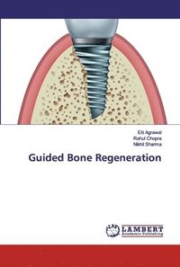 bokomslag Guided Bone Regeneration