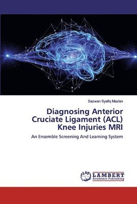 Diagnosing Anterior Cruciate Ligament (ACL) Knee Injuries MRI 1