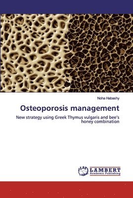 Osteoporosis management 1