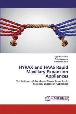 HYRAX and HAAS Rapid Maxillary Expansion Appliances 1