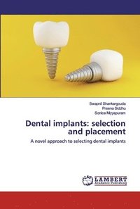 bokomslag Dental implants
