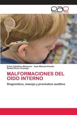 bokomslag Malformaciones del Odo Interno