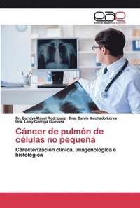 bokomslag Cancer de pulmon de celulas no pequena