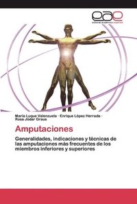 bokomslag Amputaciones