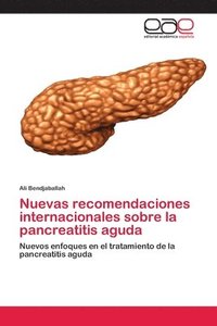 bokomslag Nuevas recomendaciones internacionales sobre la pancreatitis aguda
