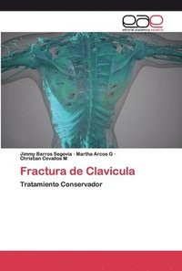 bokomslag Fractura de Clavicula