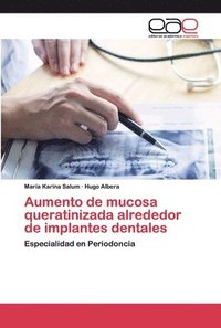 bokomslag Aumento de mucosa queratinizada alrededor de implantes dentales