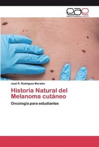 bokomslag Historia Natural del Melanoma cutneo