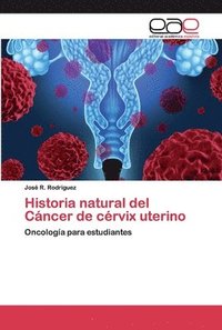 bokomslag Historia natural del Cncer de crvix uterino