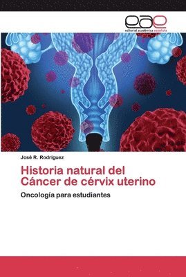 Historia natural del Cncer de crvix uterino 1