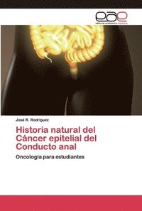 bokomslag Historia natural del Cncer epitelial del Conducto anal