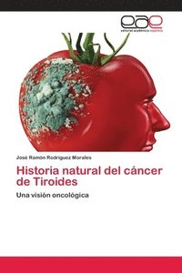 bokomslag Historia natural del cncer de Tiroides