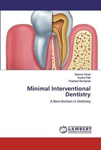 bokomslag Minimal Interventional Dentistry