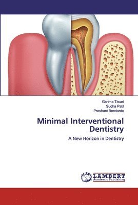 Minimal Interventional Dentistry 1