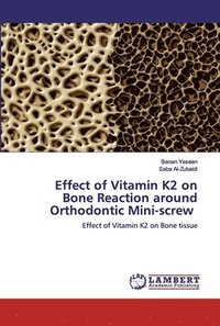 bokomslag Effect of Vitamin K2 on Bone Reaction around Orthodontic Mini-screw