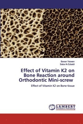 Effect of Vitamin K2 on Bone Reaction around Orthodontic Mini-screw 1