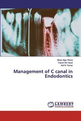 Management of C canal in Endodontics 1