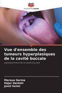 bokomslag Vue d'ensemble des tumeurs hyperplasiques de la cavité buccale