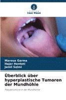 bokomslag Überblick über hyperplastische Tumoren der Mundhöhle