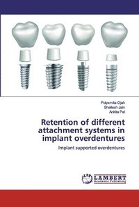 bokomslag Retention of different attachment systems in implant overdentures