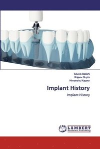 bokomslag Implant History