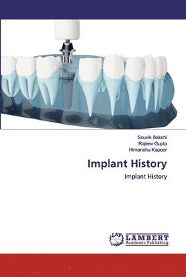 Implant History 1