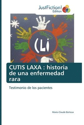 Cutis Laxa 1