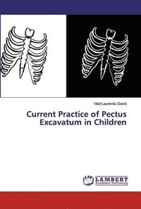 bokomslag Current Practice of Pectus Excavatum in Children