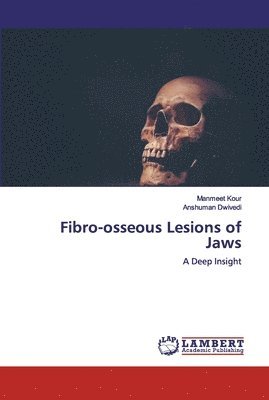 Fibro-osseous Lesions of Jaws 1