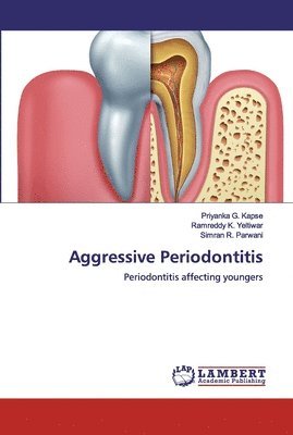 Aggressive Periodontitis 1
