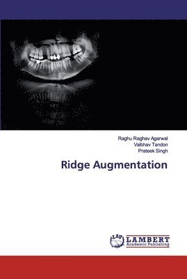 Ridge Augmentation 1