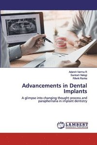 bokomslag Advancements in Dental Implants