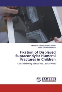 bokomslag Fixation of Displaced Supracondylar Humeral Fractures in Children
