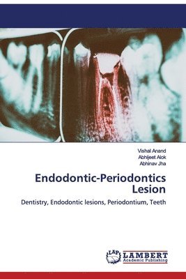 Endodontic-Periodontics Lesion 1