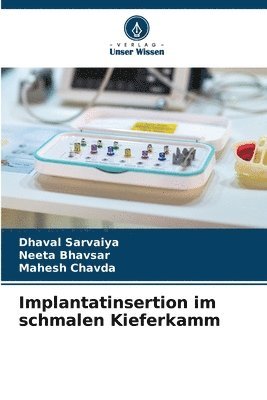 Dhaval Sarvaiya, Neeta Bhavsar, Mahesh Chavda - Implantatinsertion im schmalen Kieferkamm, Häftad