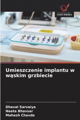 Dhaval Sarvaiya, Neeta Bhavsar, Mahesh Chavda - Umieszczenie implantu w wąskim grzbiecie, Häftad