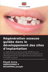 bokomslag Régénération osseuse guidée dans le développement des sites d'implantation