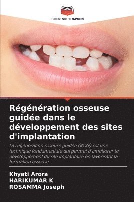 Khyati Arora, Harikumar K, Rosamma Joseph, HARIKUMAR K - Régénération osseuse guidée dans le développement des sites d'implantation, Häftad