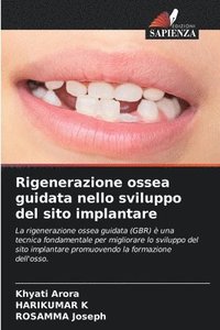 bokomslag Rigenerazione ossea guidata nello sviluppo del sito implantare