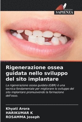 bokomslag Rigenerazione ossea guidata nello sviluppo del sito implantare