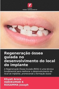 bokomslag Regeneração óssea guiada no desenvolvimento do local do implante