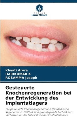 bokomslag Gesteuerte Knochenregeneration bei der Entwicklung des Implantatlagers