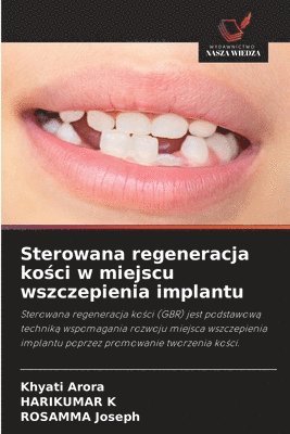 bokomslag Sterowana regeneracja ko?ci w miejscu wszczepienia implantu