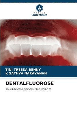 bokomslag DENTALFLUOROSE