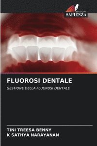 bokomslag Fluorosi Dentale